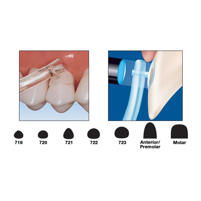 Cure-Thru® Clear Cervical Matrices by Premier